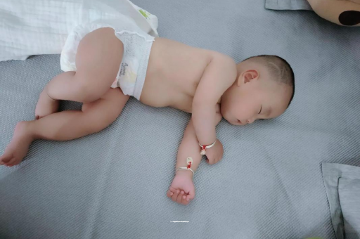 南充六个月宝宝眼睛散光